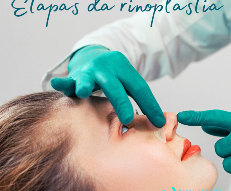 Mulher com Rinoplastia