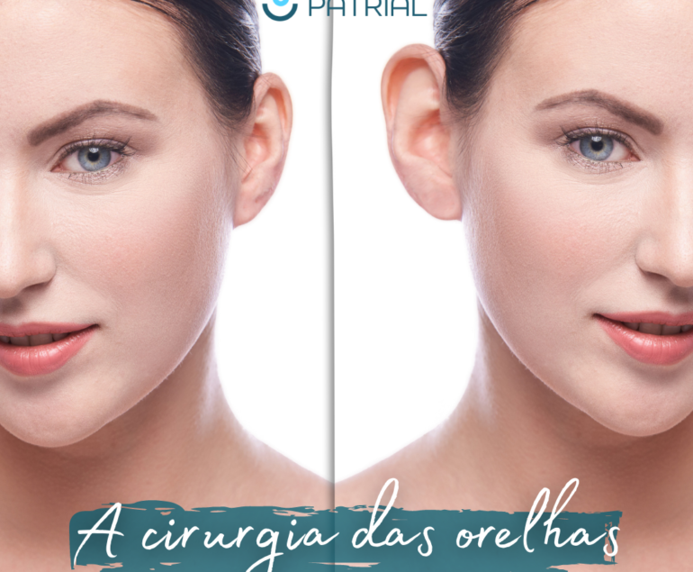 mulher com otoplastia