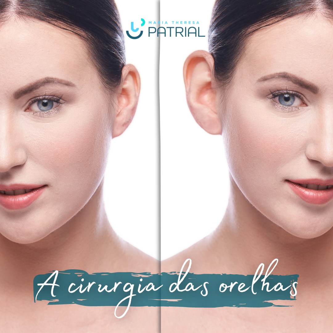 mulher com otoplastia