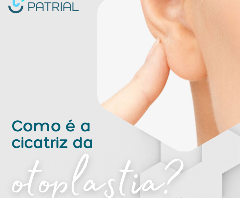 Orelha com otoplastia