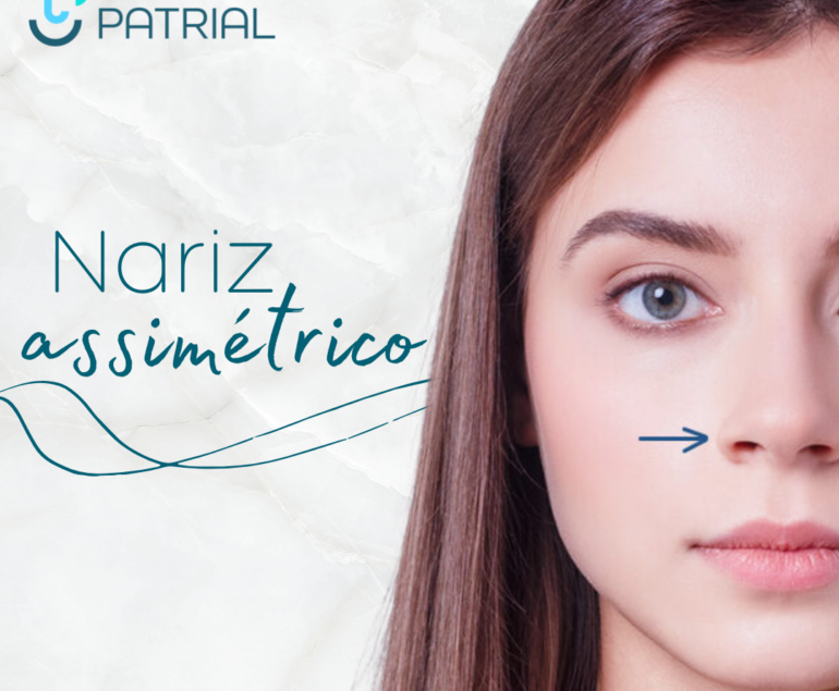 Mulher com nariz assimétrico