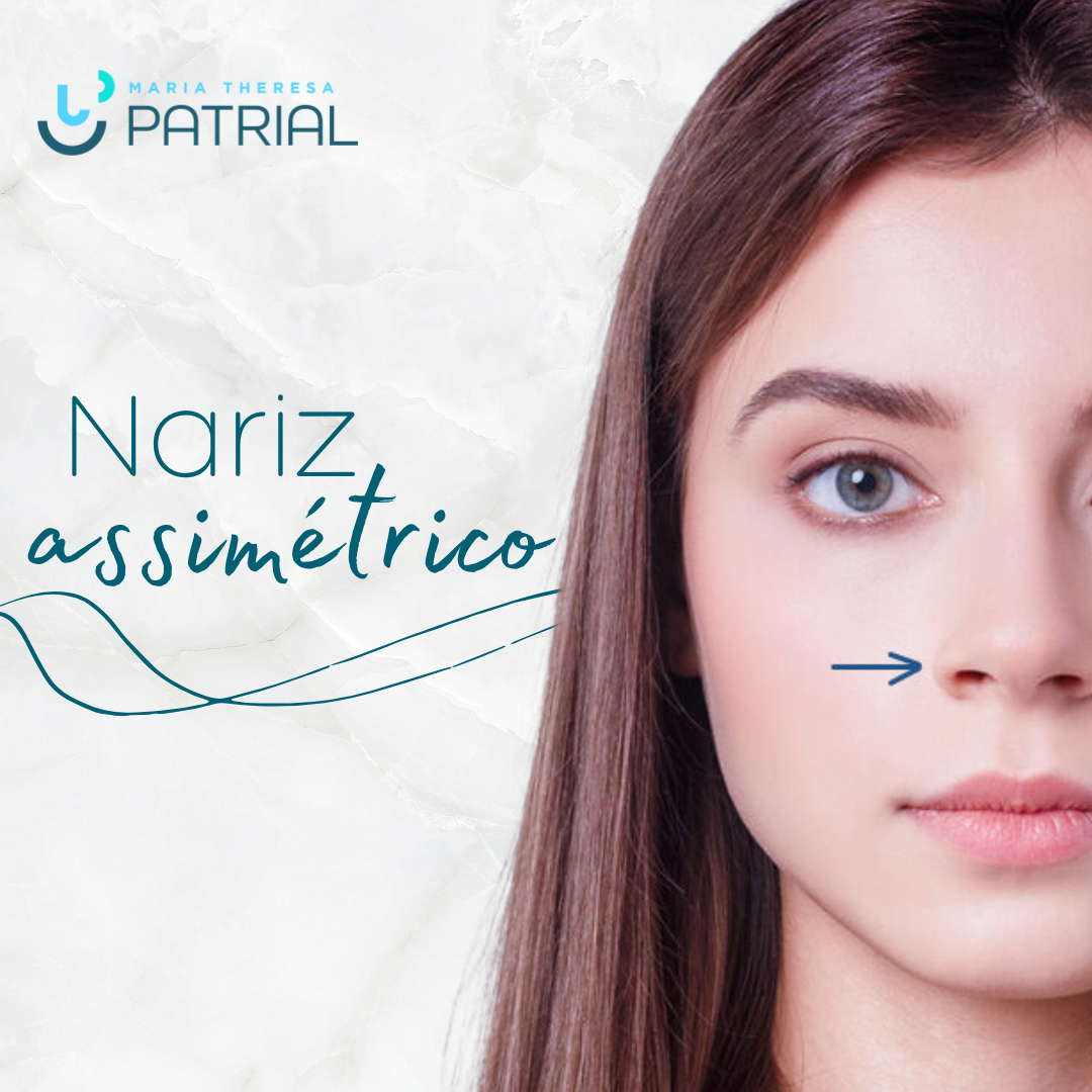 Mulher com nariz assimétrico
