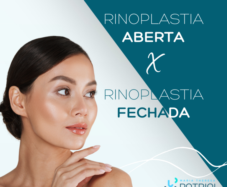 Mulher com rinoplastia