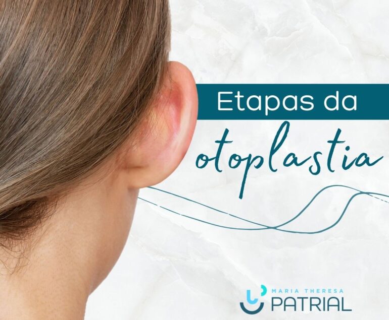 Cirurgia da orelha