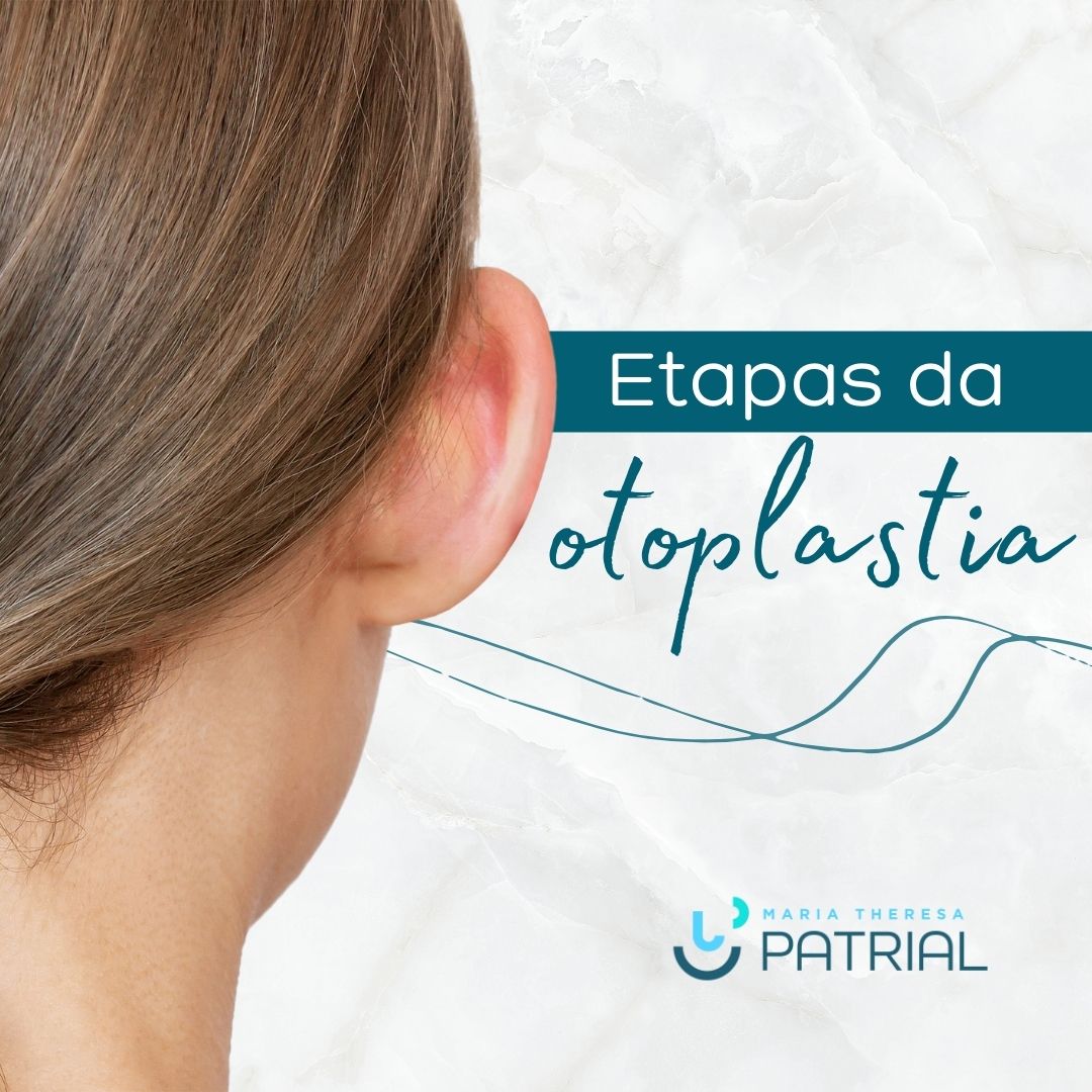Cirurgia da orelha