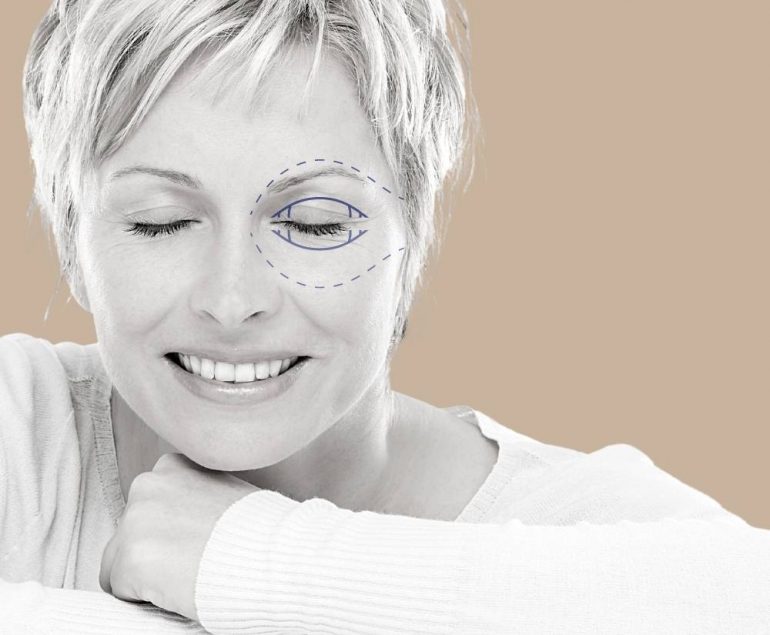 rinoplastia curitiba