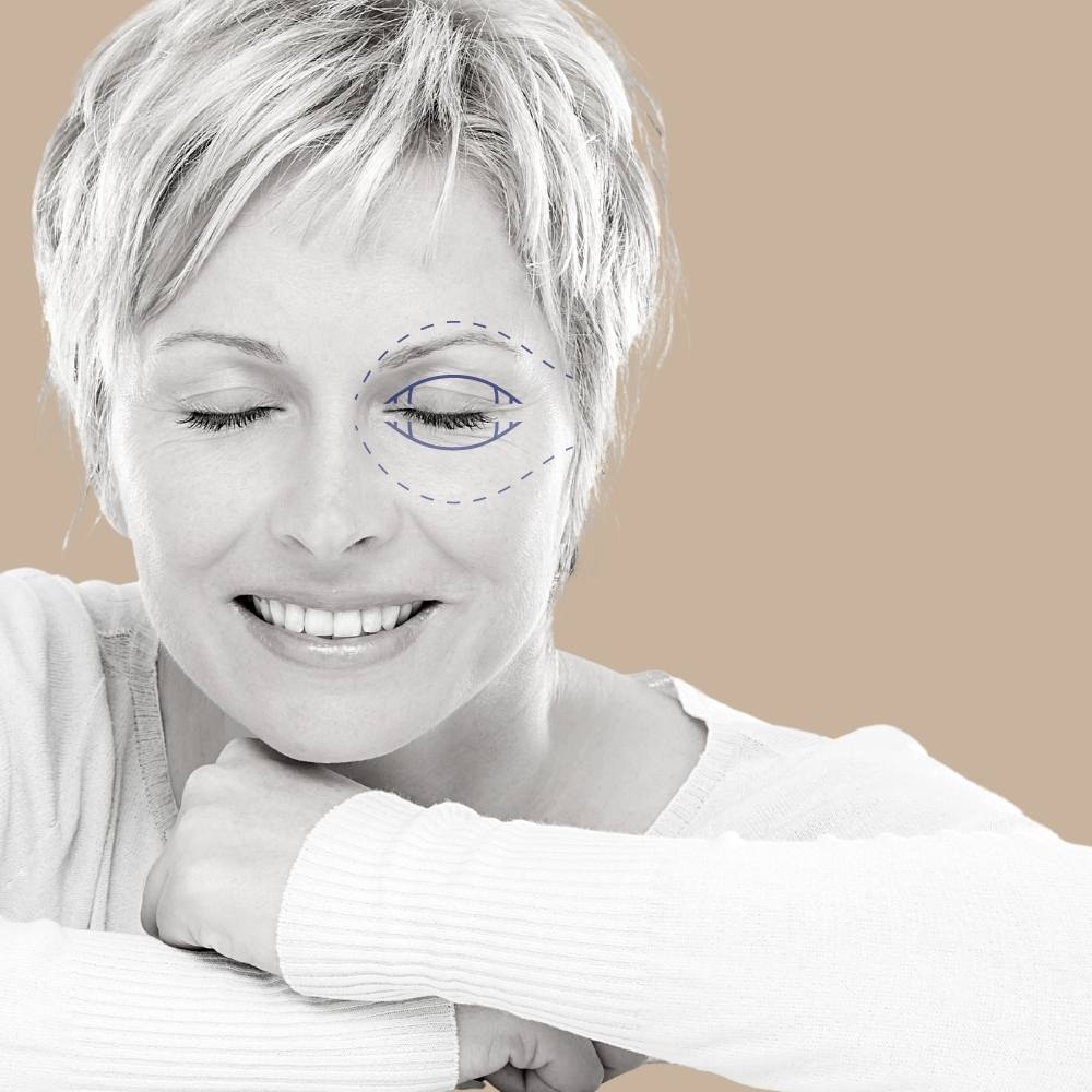 rinoplastia curitiba