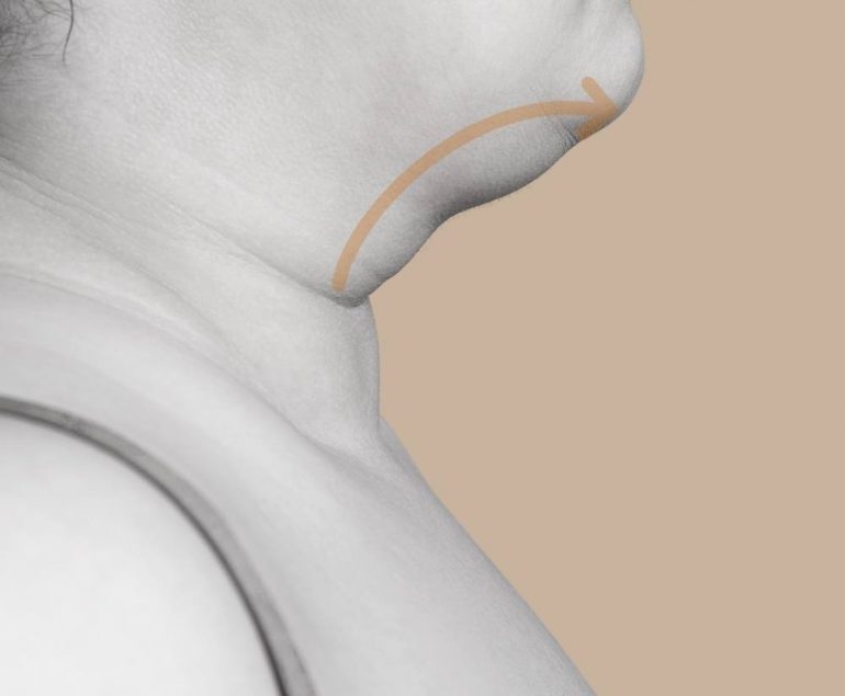 rinoplastia curitiba