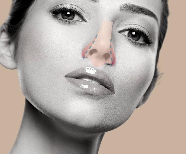 rinoplastia curitiba