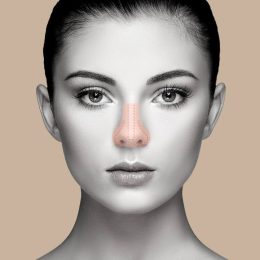 rinoplastia curitiba