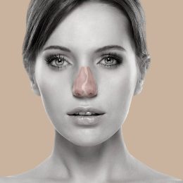 rinoplastia curitiba